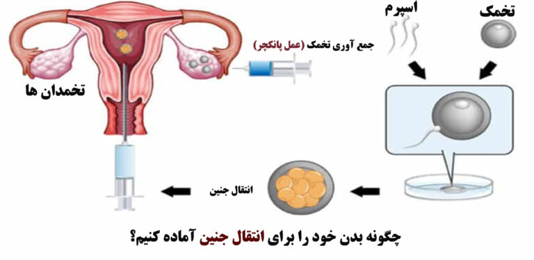 چگونه بدن خود را برای انتقال جنین آماده کنیم؟